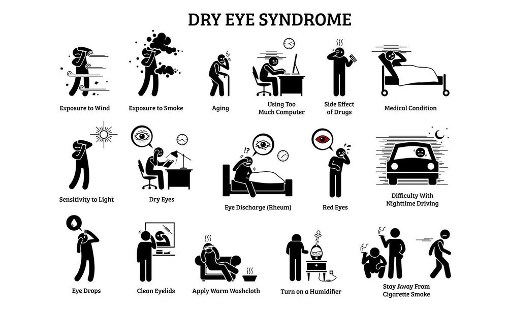 Dry Eye Illustration