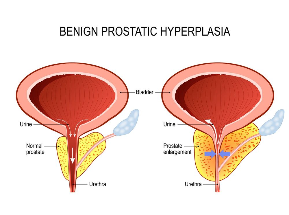 Medical Cross Section